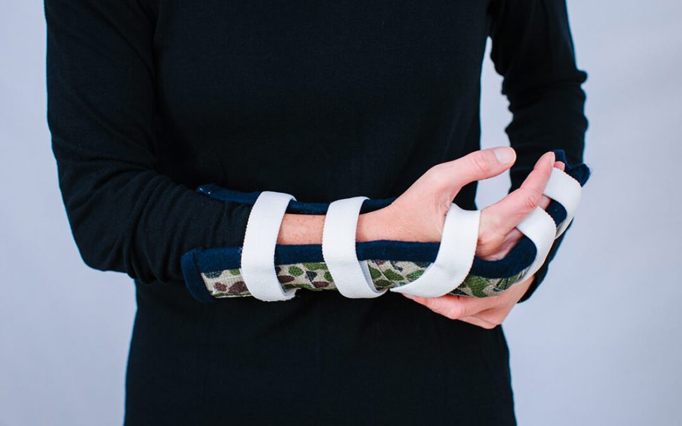 Wrist Fracture Archives Virtual Hand Care