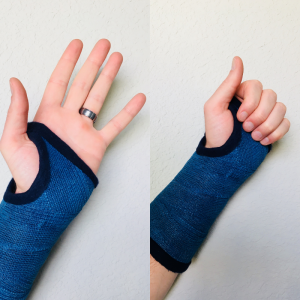 finger exercises in a cast