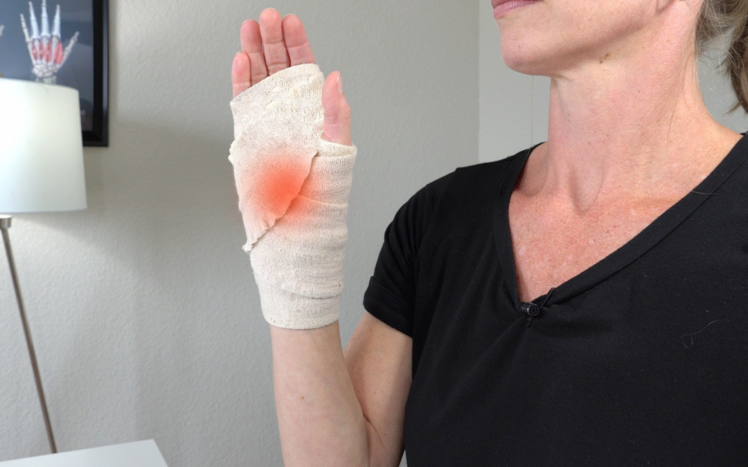 How to Prepare for Carpal Tunnel Surgery