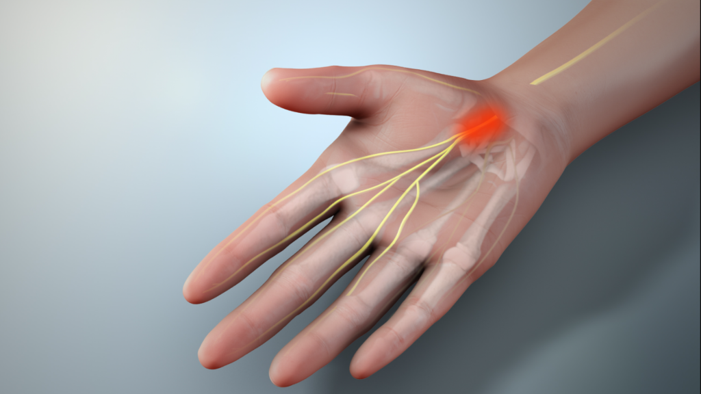 Help for Numbness and Tingling in Your Hand: Carpal Tunnel Relief