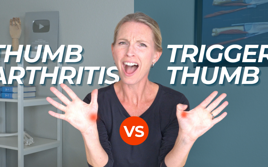 Trigger Thumb versus Thumb CMC arthritis: What’s the difference?